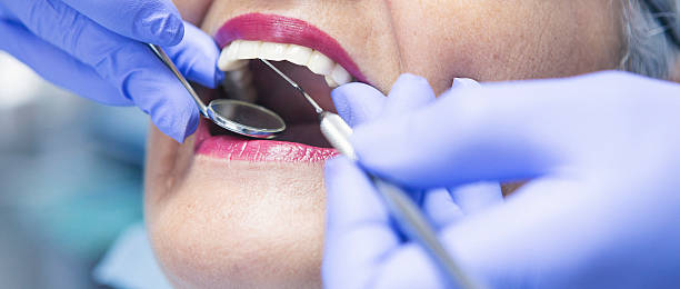 Best Emergency Dentist for Knocked-Out Tooth in Magnolia, TX